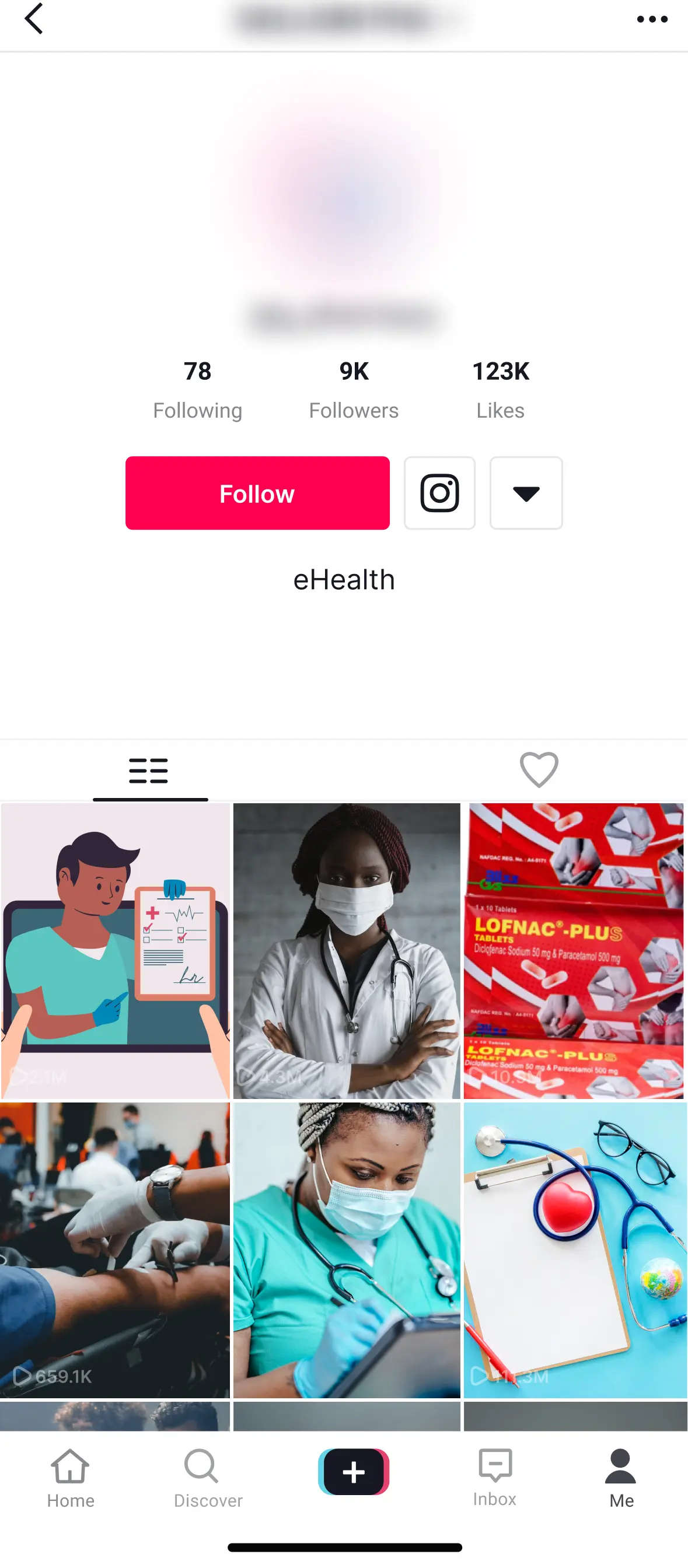 ig_after_img_alt